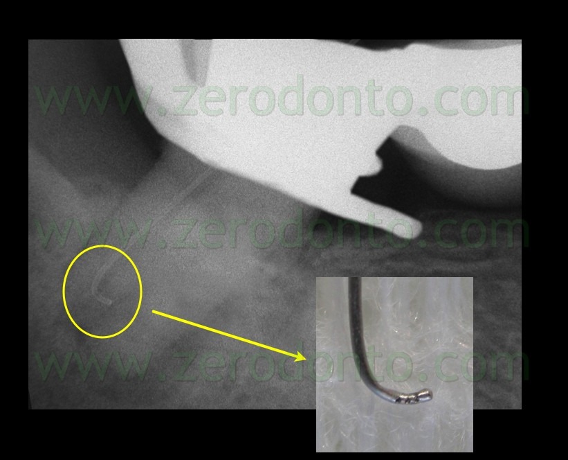 [FIG-N-162.jpg]