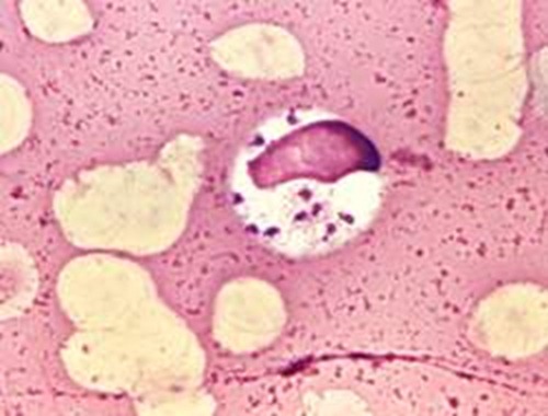 A busca por medicamentos contra doenças sem interesse comercial3