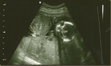 babyaug1