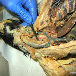esophagus_probe.JPG