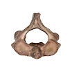 Vertebrae_C2_female.jpg