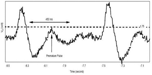 Digital Blood Pressure Meter