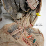 fetal_pig_common_iliac_labeled.jpg