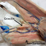 gracilis_sartorius.jpg