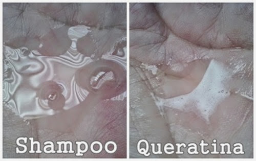 cauterização cauterização