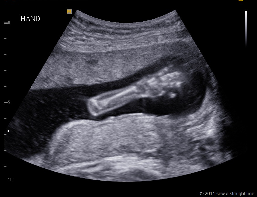 [BABY%2520GUBLER_0002%255B9%255D.jpg]