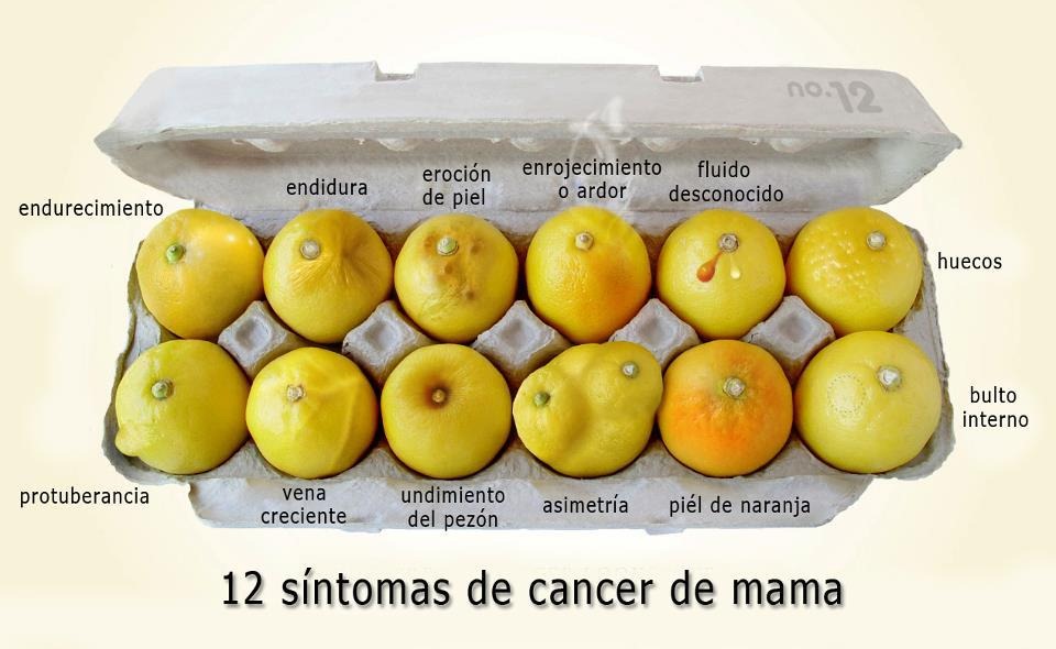 [12%2520sintomas%2520del%2520cancer%2520de%2520mama%255B6%255D.jpg]