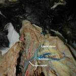 subclavian_vein_L.JPG