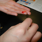 blood_after_lancet.JPG