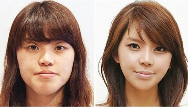 [korean-plastic-surgery-9%255B2%255D.jpg]