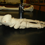foot_medial_unlabeled.JPG