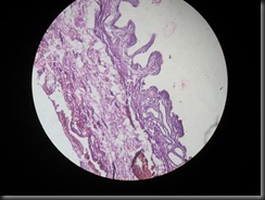 chronic cholecystitis high resolution histology slide tsnaps
