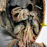 fetal_pig_ureter.JPG