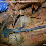 kidneys_L.JPG