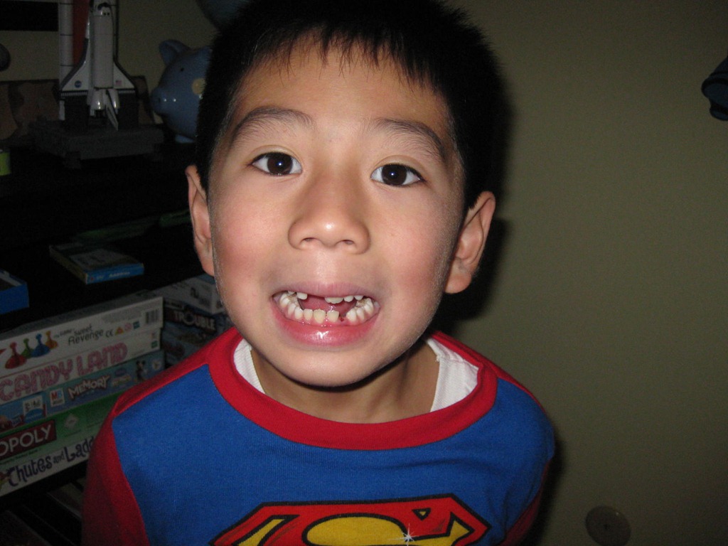 [missing_tooth5%255B3%255D.jpg]