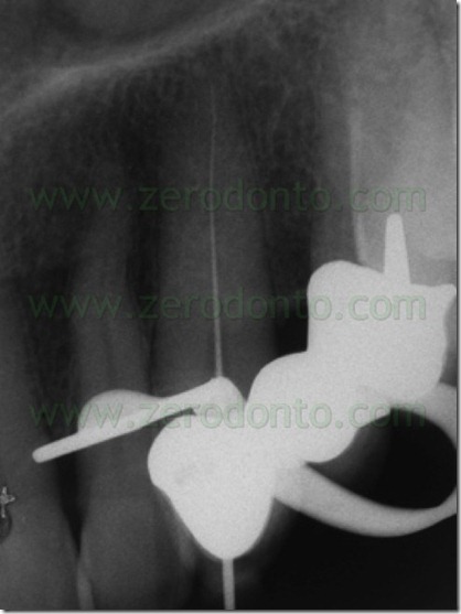 FIG N 21