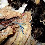 brachiocephalic_vein_L.JPG
