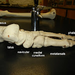 foot_medial_labeled.JPG