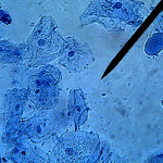 cheek09.jpg