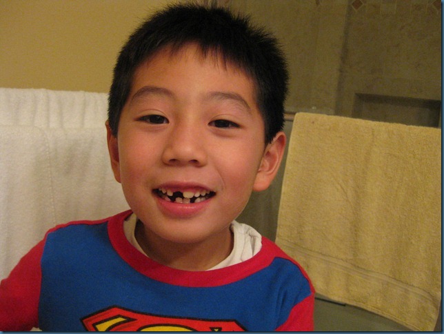 missing_tooth4