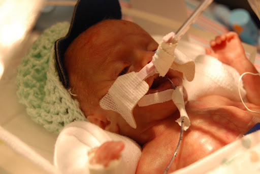 Austin, son of Joe and Tracey Brown, was 1 lb, 7 oz at birth. He lived for three days before developing a grade-four brain hemorrhage. He passed away in his parents' arms. (Photo provided by Tracey Brown)