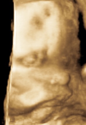 [ROWLEETRISTAN20111130143249603%255B3%255D.jpg]
