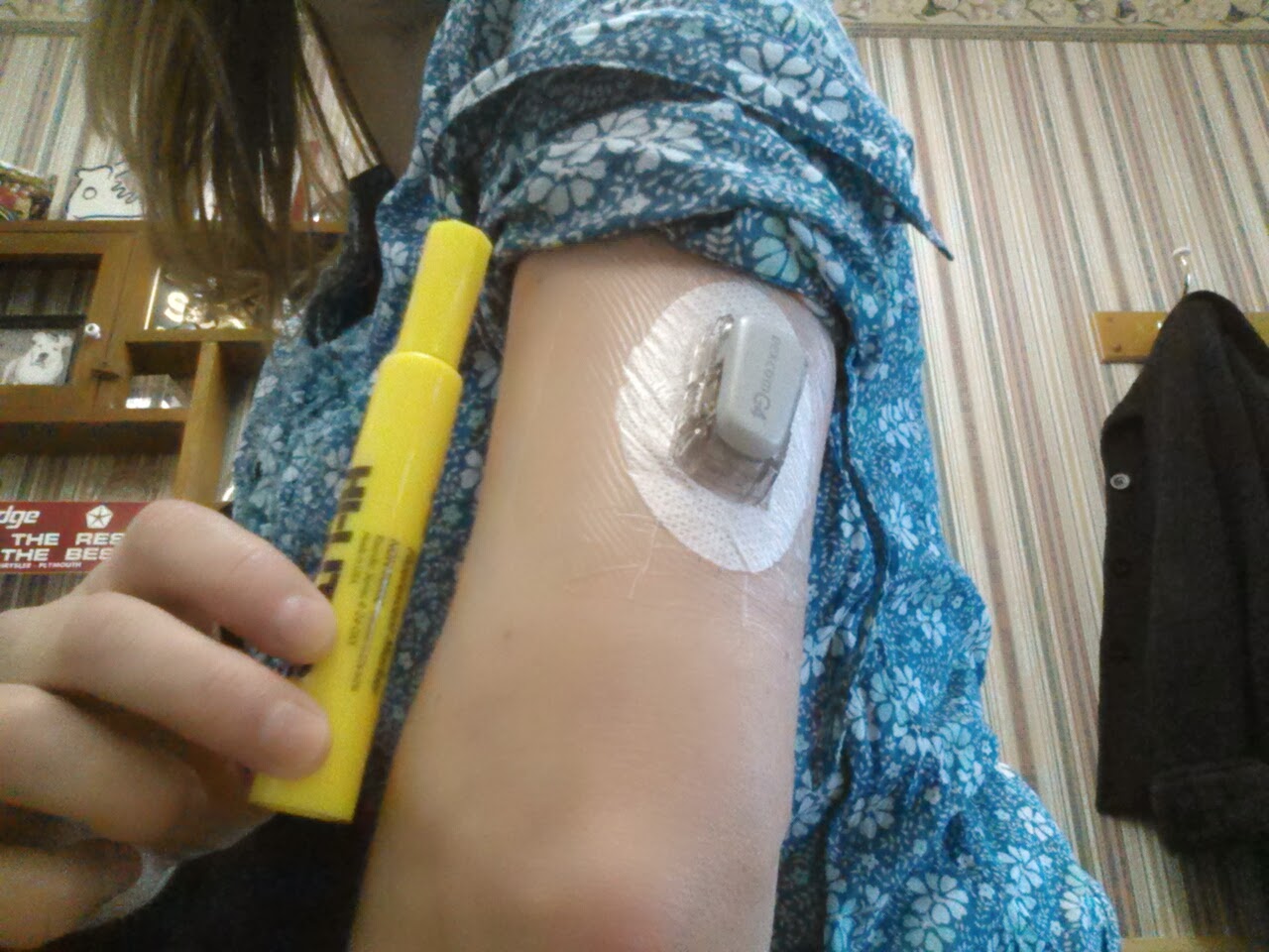 I am a Type 1 Diabetic Warrior Dex on my chicken arm