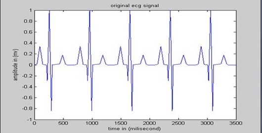 ECG signal from electrode ECG signal from electrode