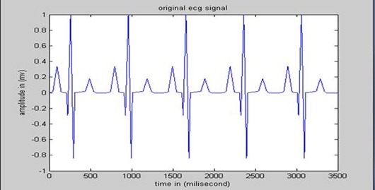 ECG signal from electrode 