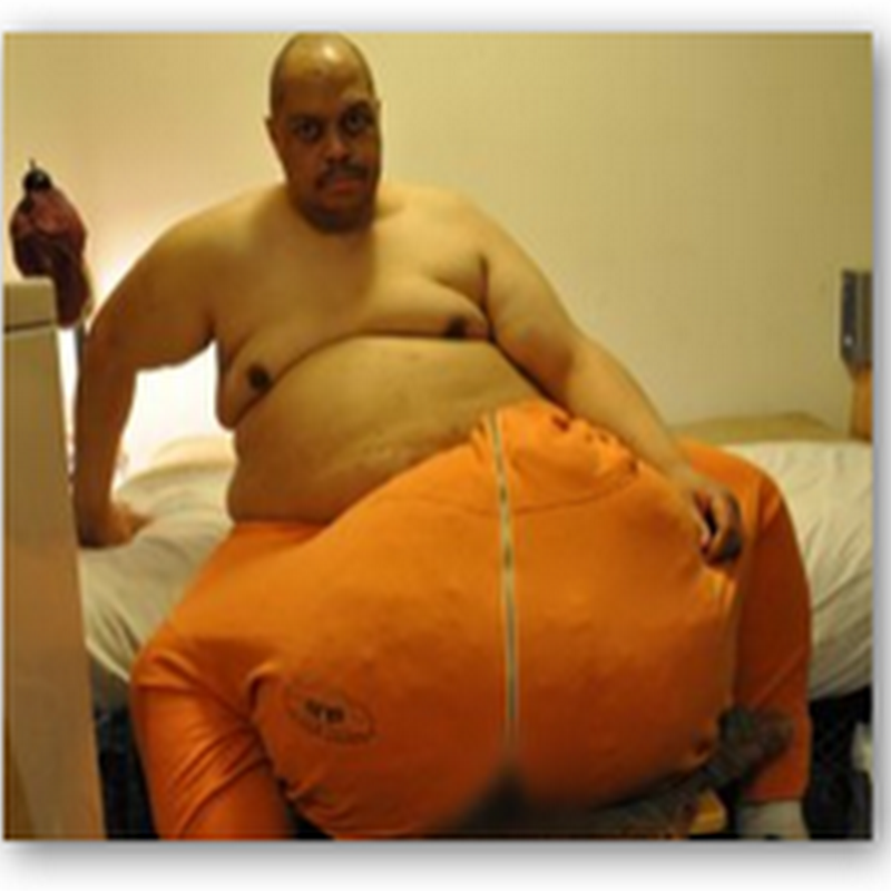 Man With 132 Pound Scrotum Finally Has Surgery and Gets Relief..Could Not Afford the Cost And Had to Find A Way…