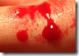 Blood Blood