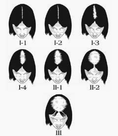 [pic-women-hair-loss1%255B2%255D.jpg]