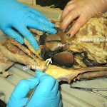 gall_bladder_liver_L.JPG