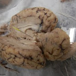 brain_pineal_pinned.JPG