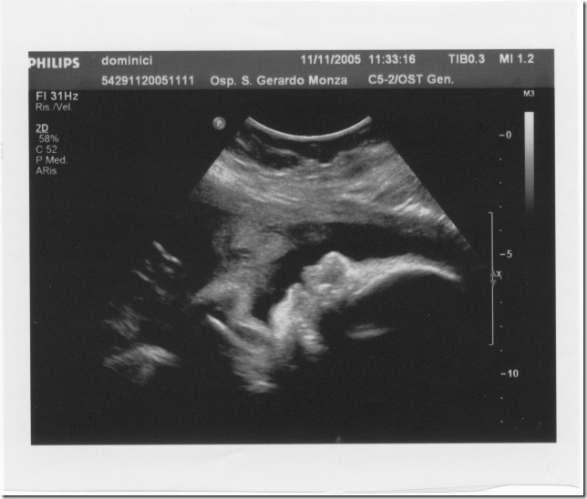scan0[1]