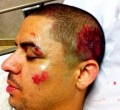 larry hernandez accidente fotos cara