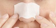 [blackheads3.jpg]