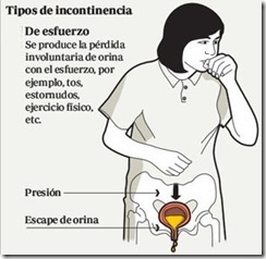 incontinencia urinaria de esfuerzo
