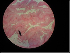 TCC high resolution histology slide tsnaps TCC high resolution histology slide tsnaps