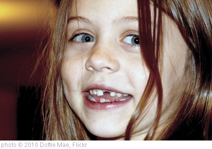 'Girl with Missing Teeth' photo (c) 2010, Dottie Mae - license: http://creativecommons.org/licenses/by/2.0/