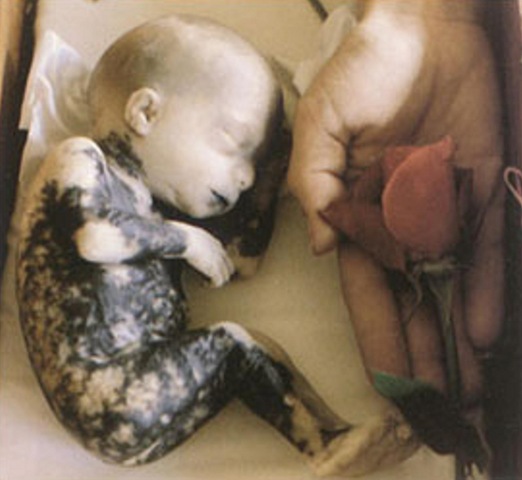 [Abortion%255B2%255D.jpg]