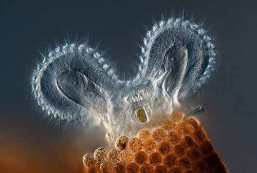 s_b13_0rotifer copy.jpg S b13 0rotifer copy