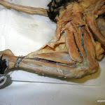 gastrocnemius.JPG