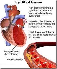 information-on-high-blood-pressure