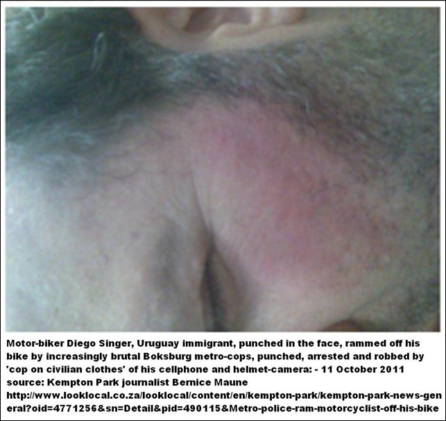 SINGER Diego Uruguay immigrant knocked off bike by Boksburg Metrocops and robbed Sept112011