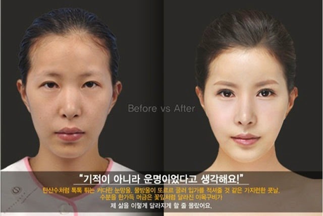 [korean-plastic-surgery-32%255B2%255D.jpg]