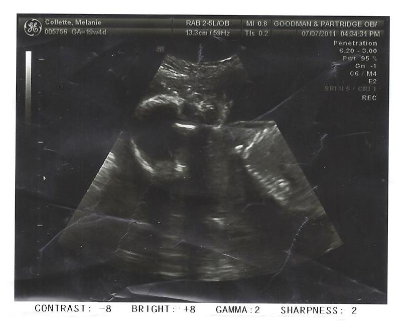 [Baby%255B6%255D.jpg]