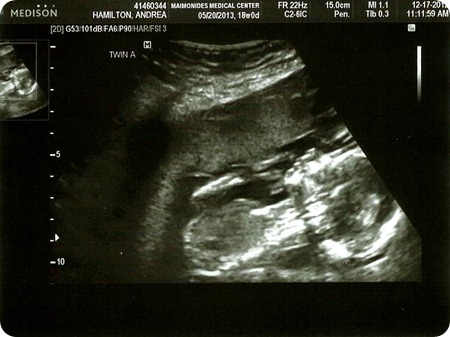 Baby A Baby Girl profile 18 Weeks