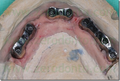 mesostrutture