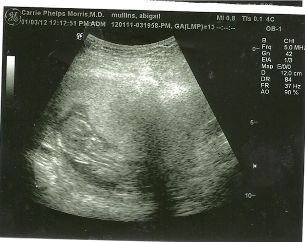 [baby%2520boy%252010004%255B3%255D.jpg]
